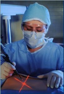 surgeon works with a laser
